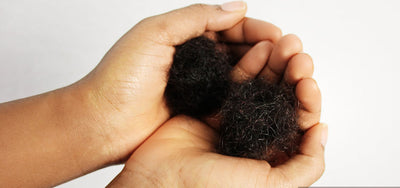 COVID-19 & shock hair loss