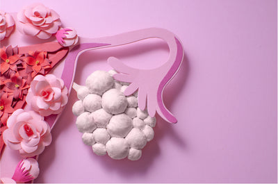 How does PCOS affect your hair?