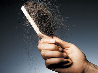 Understanding your hair loss